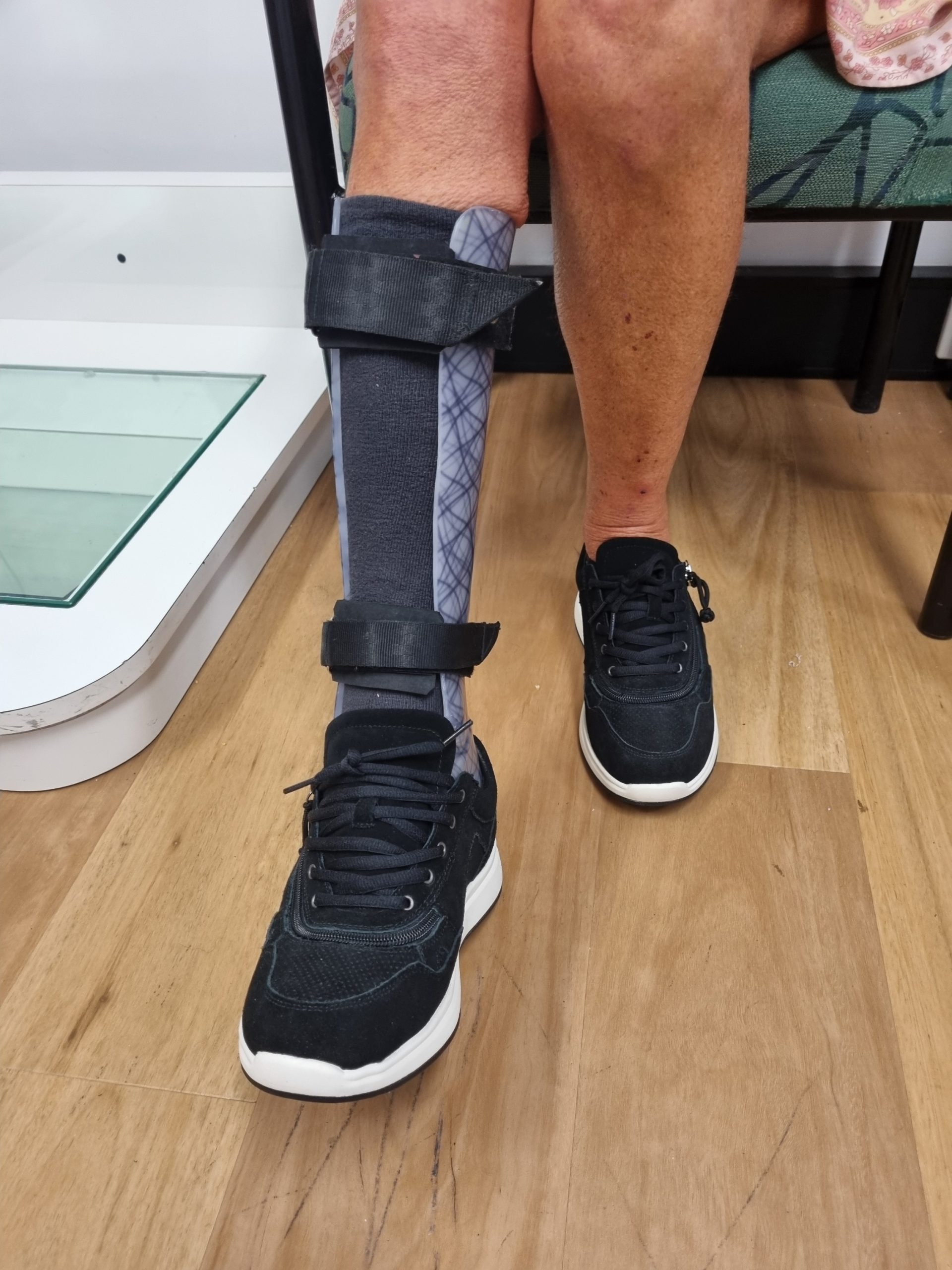 Orthotic Services - Feet First Orthotics & Prosthetics | Artificial Leg ...