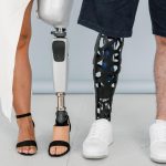 AI-Powered Prosthetic Legs: The Future of Personalized Mobility