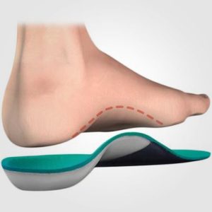 Everything You Need to Know Before Getting Orthotics
