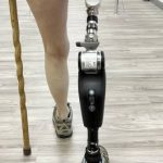 How Much Do Microprocessor Knees and Feet Cost?