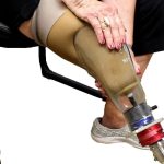 Hydraulic vs. Microprocessor Knees: Understanding Your Options