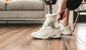 Microprocessor Prosthetic Feet: Features, Benefits and Limitations