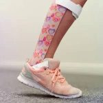 How Ankle-Foot Orthoses Help Improve Walking After Stroke