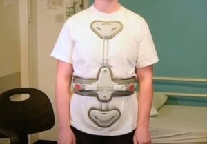 How Does a Spinal Brace Support Your Spine?