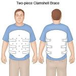 How Long Do You Need to Wear a Spinal Brace?