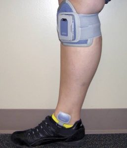 How Orthotic Treatment Can Support Stroke Recovery