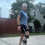 How Physiotherapy Supports Fracture Recovery for Prosthetic Users