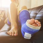 How to Safely Return to Walking After a Leg Fracture