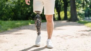 Rehabilitation After a Leg Fracture: Considerations for Prosthetic Users