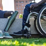 Returning to Mobility After a Leg Fracture With a Prosthesis