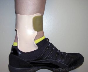 Understanding Orthoses After Stroke: A Beginner’s Guide