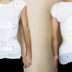 What Is a Spinal Brace and How Does It Work?