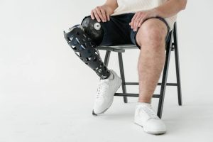 How to Choose the Best Below-Knee Prosthesis for Your Lifestyle
