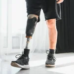 How to Choose the Best Below-Knee Prosthesis for Your Lifestyle