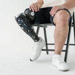 What Factors Affect the Cost of a Below-Knee Prosthetic Leg?