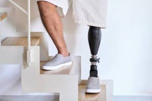 What Factors Affect the Cost of a Below-Knee Prosthetic Leg?
