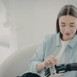 What Should You Look for in a Prosthetics Clinic?